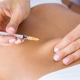 Endometriozis ve Nöralterapi - Prof. Dr. Engin Oral