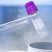 Endometrioziste Yumurta Dondurma - Prof. Dr. Engin Oral